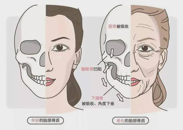 面相骨骼_bone骨骼链接到bip骨骼_徐子淇面相分析 豪门媳妇面相