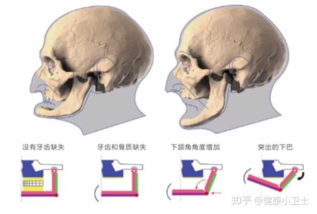 人体面部骨骼结构图_骨骼清奇面相_面部骨骼图片面相剖析