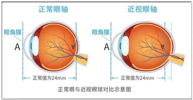 眼睛面相看眼睛代表什么，一起来涨知识！！