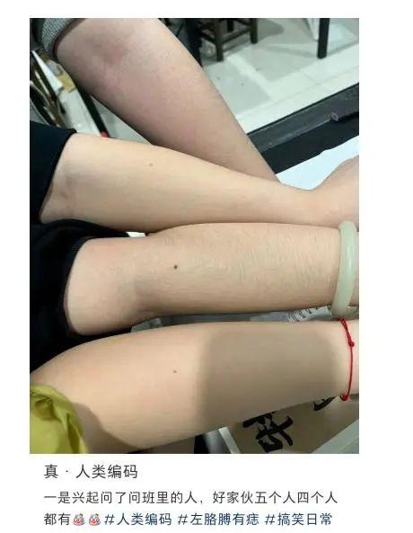 胳膊同一位置长痣，是女娲娘娘盖的戳还是另有原因？